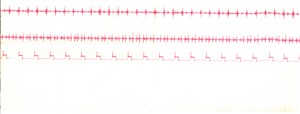 Image accompanying MP3 audio clip: The first baby heart monitor ( KB)